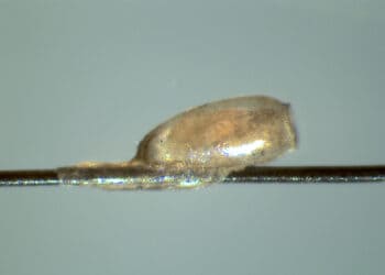 Head lice are being used to hlp recover human DNA from the past. Picture: University of Reading