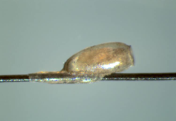 Head lice are being used to hlp recover human DNA from the past. Picture: University of Reading