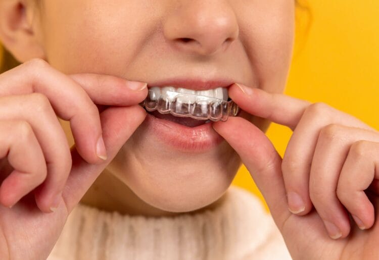 Teeth