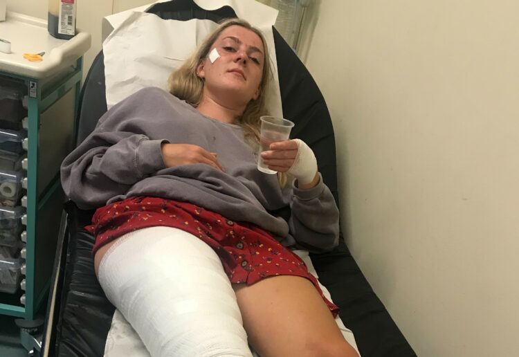 Leone Cook, 18, suffered the injuries on the last day of Reading Festival Picture: Leone Cook