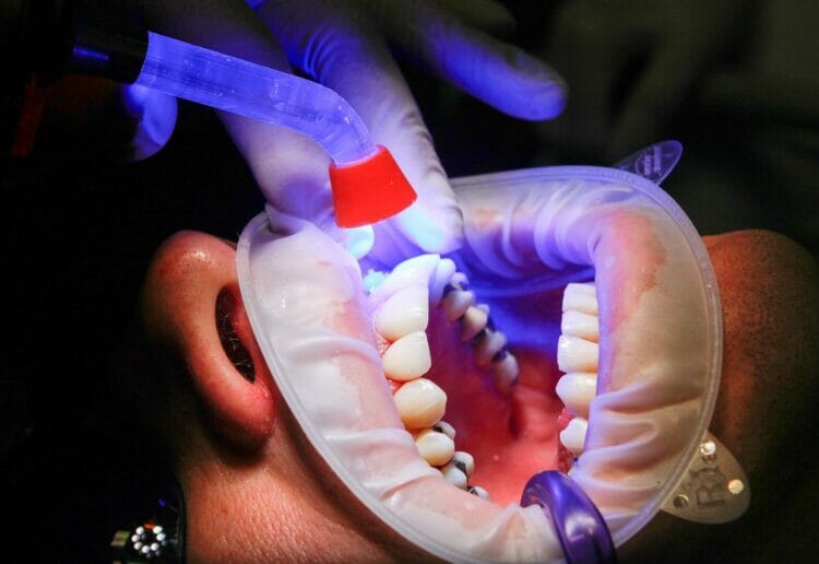 Dentists are not offering enough services to NHS patients say Reading Green Party Picture: Ale? Kartal from Pixabay