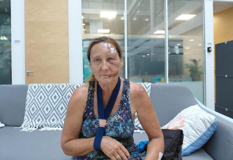 Elaine Parry, a mum in her 60s, was cycling when she was hit by an e-scooter rider at the A33 junction with Rose Kiln Lane in Reading on August 2. Credit: James Aldridge, Local Democracy Reporting Service