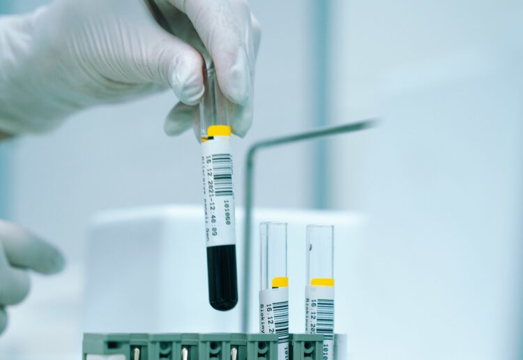 The University of Reading has produced a new blood test which could spare survivors of heart attacks and strokes from repeat incidents. Picture: Akram Huseyn via UnSplash